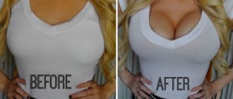 How to make breasts firmer at home
