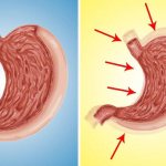 How to reduce stomach volume: Proven methods