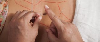 Losing weight with acupuncture
